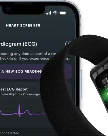 WHOOP MG Sensor — Life — 12-Month Membership